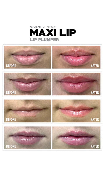 Maxi Lip